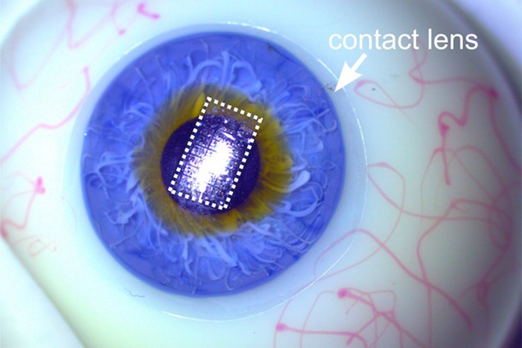 مداری الکترونیکی و شفاف با قابلیت قرار گرفتن در لنز چشم