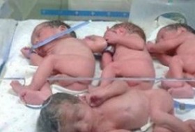 عکس: تولد نوزادان چهار قلو در مشهد