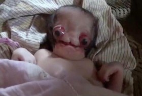 تولد نوزاد عجیب‌الخلقه شبیه به موجودات فضایی در هند+ تصاویر (۱۴+)