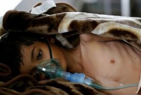 مرگ کودک یمنی پس از دیدار با مادرش در آمریکا