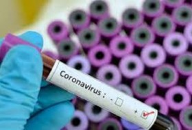 آخرین آمار کرونا در ایران؛ تعداد مبتلایان به ویروس کرونا به ۴۷۴۷ نفر افزایش یافت