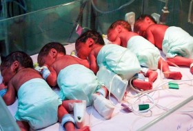 2 نوزاد پسر از 6 قلوهای مشهور کرجی فوت کردند/ علت فوت 2 قلوها خونریزی ریه اعلام شد
